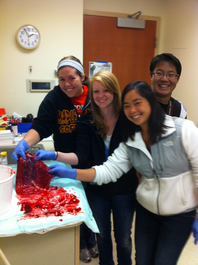 The team got to see a real placenta at St. Marys Hospital