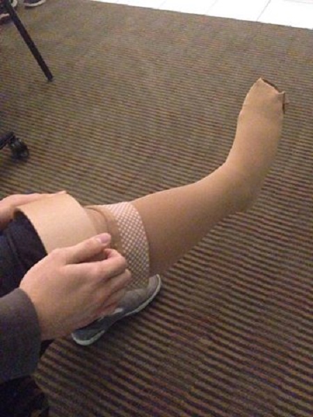 Usage of Cuff Roller and Redesigned Stocking