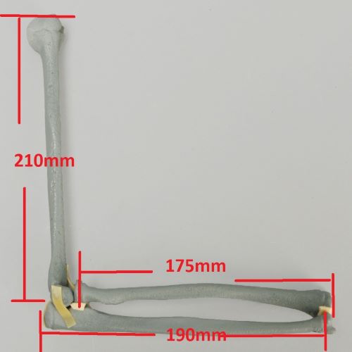 Sawbones Bone Model