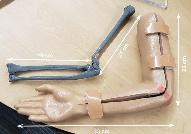 Final Model