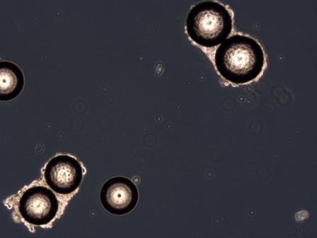 Image (10x magnification) of collagen coated beads seeded with T47D breast cancer cells demonstrating good cell attachment.