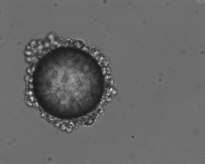 Image (20x magnification) of a collagen coated bead seeded with T99 glioblastoma cells demonstrating excellent cell attachment.