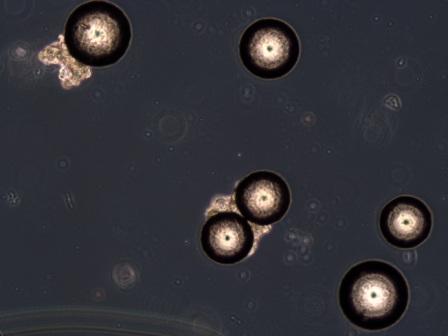 Image (10x magnification)of plain polystyrene beads seeded with T47D breast cancer cells showing limitated cell attachment.
